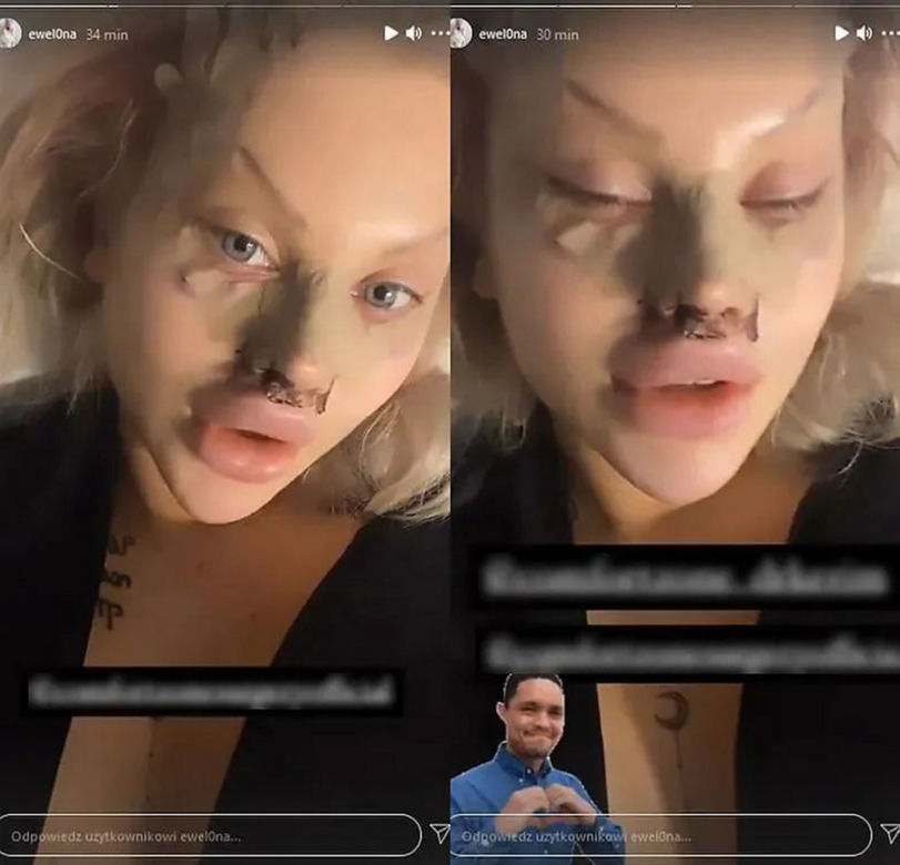 Ewelina z Warsaw Shore przesadziła z operacjami