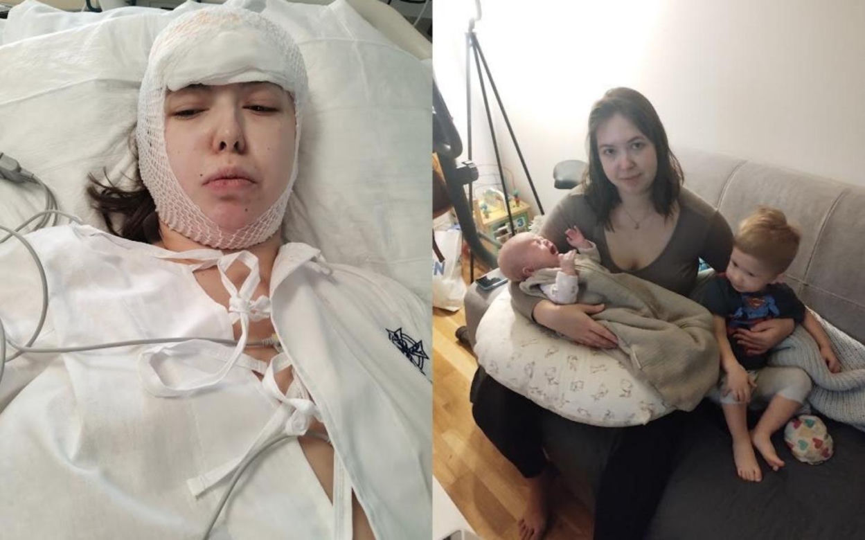 Życie Moniki wywróciło się do góry nogami. Torunianka walczy z glejakiem