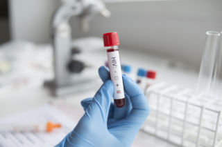 Wzrost zakażeń HIV w Krakowie. Szpital przekazał niepokojące dane