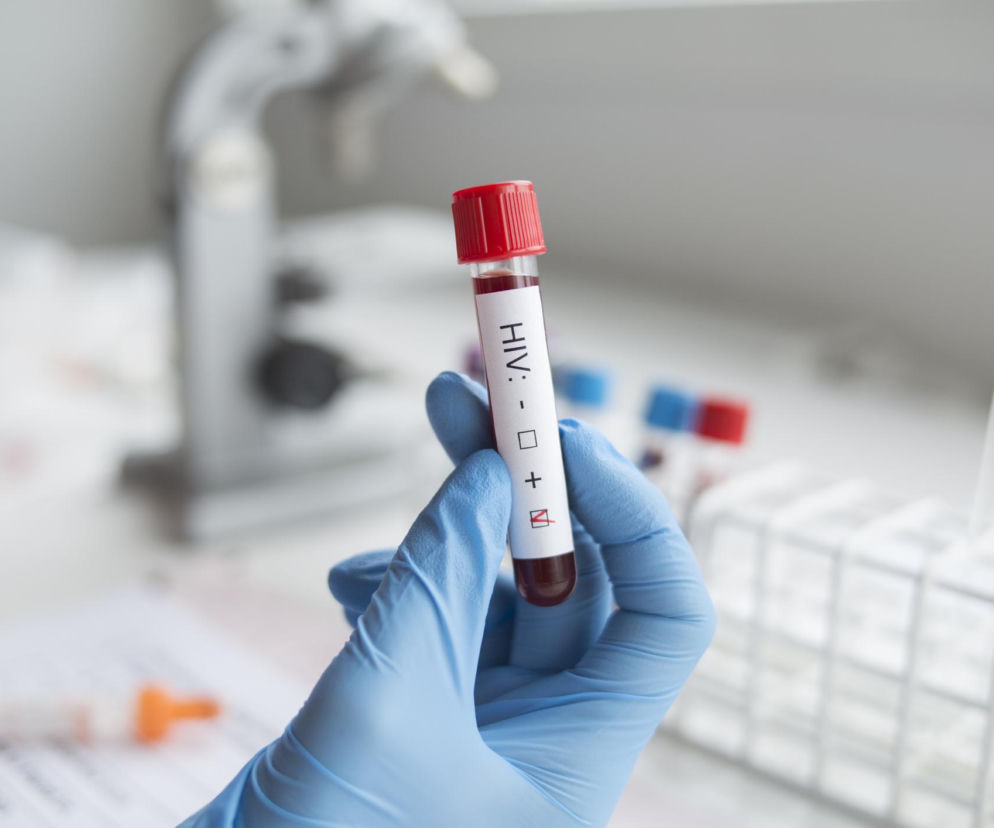 HIV atakuje coraz mocniej. Krakowski szpital ujawnia niepokojące dane o AIDS