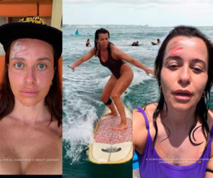 Malwina Wędzikowska miała groźny wypadek