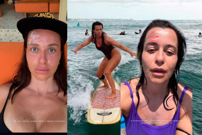 Malwina Wędzikowska miała groźny wypadek