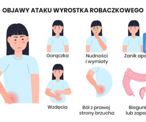 Objawy ataku wyrostka robaczkowego