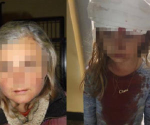 Bezdomna rzuciła kostką brukową w głowę Oliwki