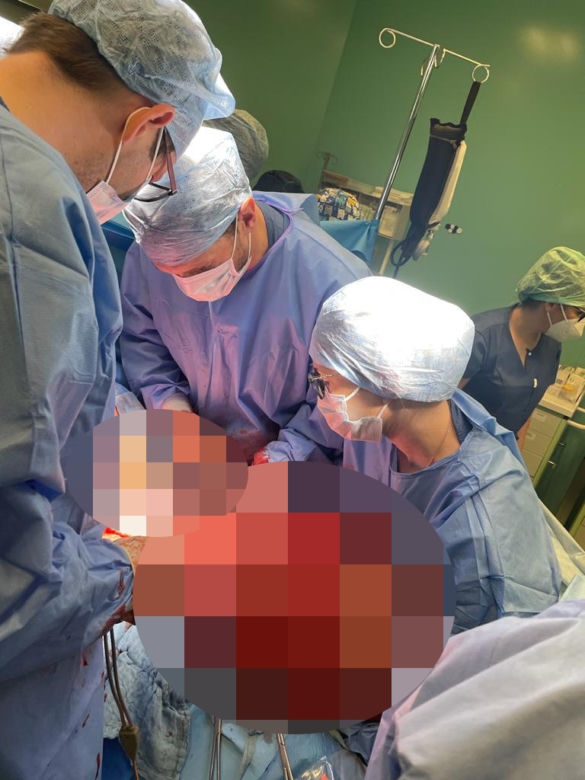 Lekarze ze szpitala Latawiec usunęli gigantycznego guza 38-letniej pacjentce