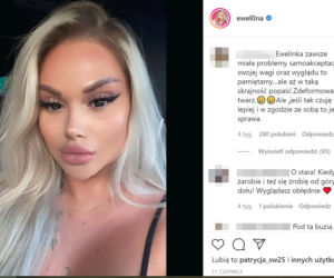 Ewelina z Warsaw Shore przesadziła z operacjami