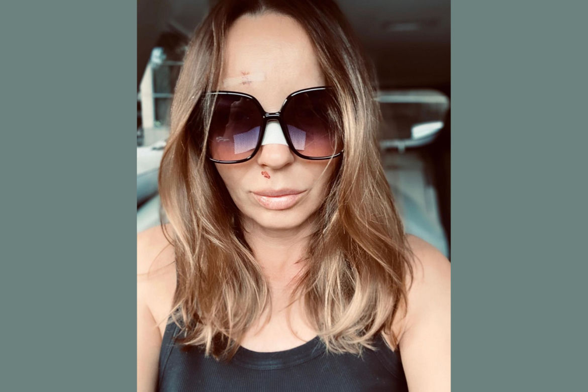 Agnieszka Włodarczyk w szpitalu. Obudziła się we krwi 