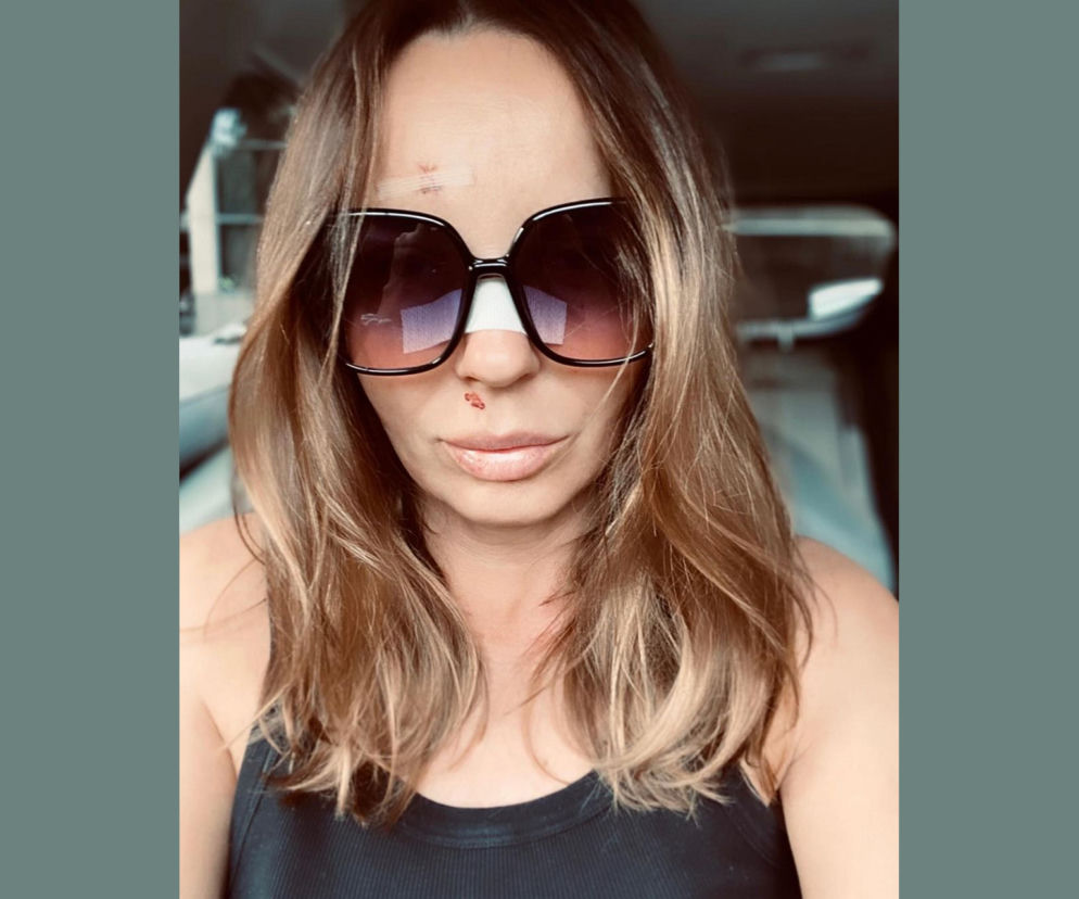 Agnieszka Włodarczyk w szpitalu. Obudziła się we krwi 