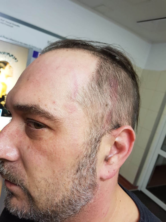 Dostałem zawału przez policję