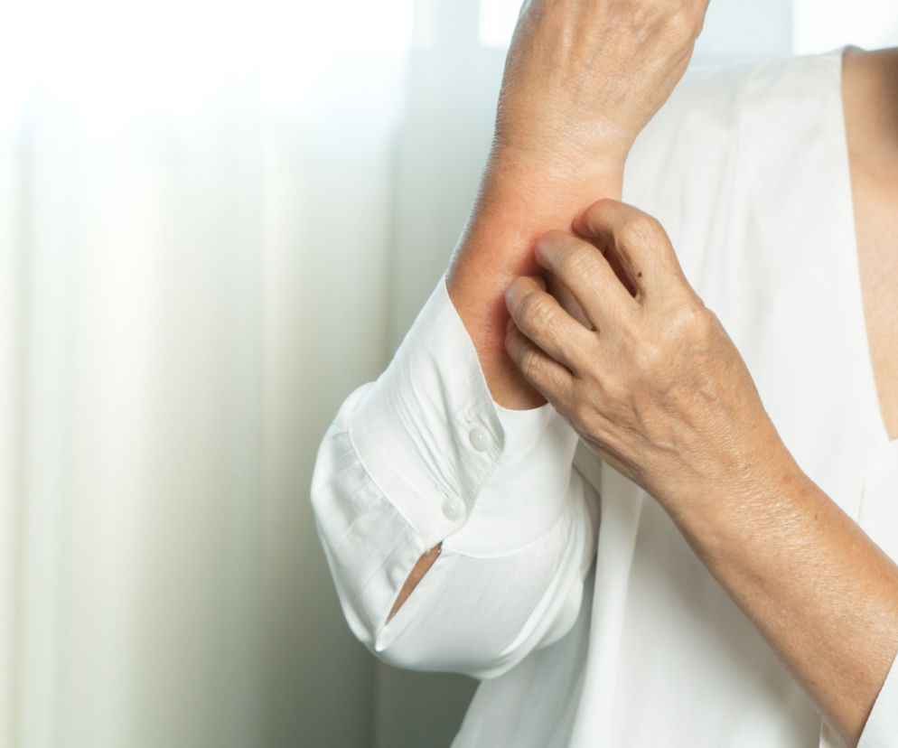 Objawy dermatologiczne COVID-19 