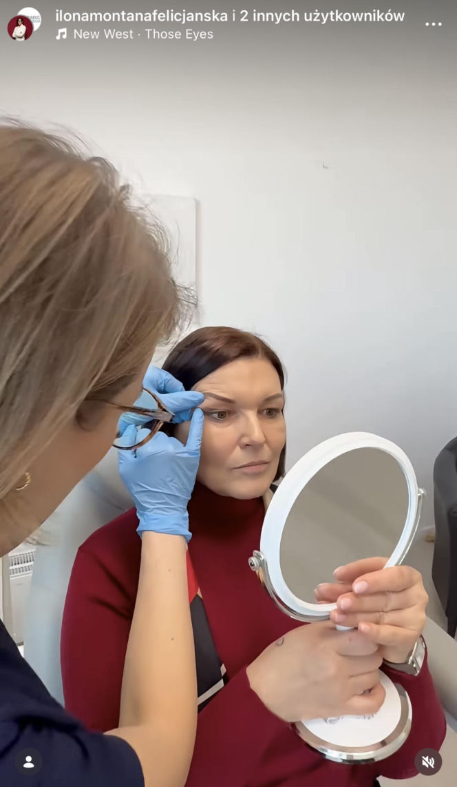 Ilona Felicjańska wycina sobie powieki