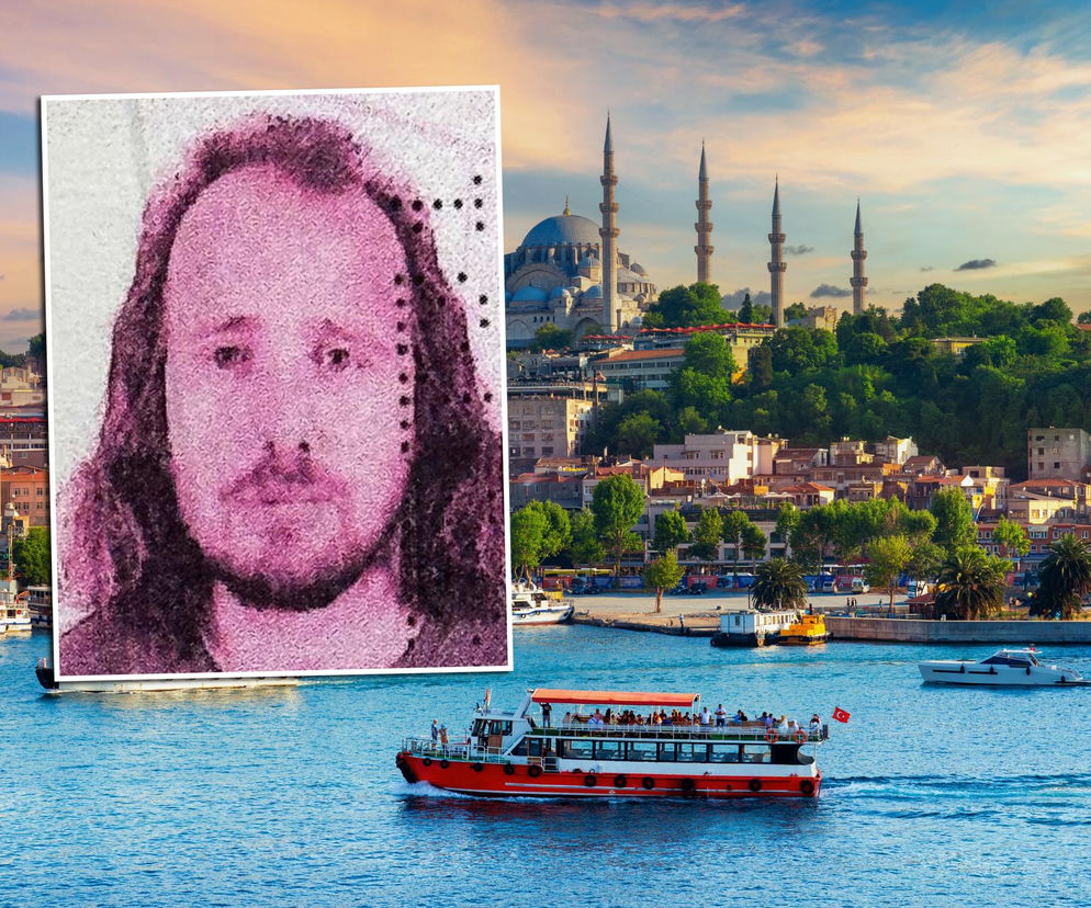 Umarł po przeszczepie włosów! Pojechał na operację do Turcji