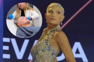 Miss USA jako 21-latka straciła wszystkie włosy! Teraz ma szansę wygrać tytuł Miss World [ZDJĘCIA]