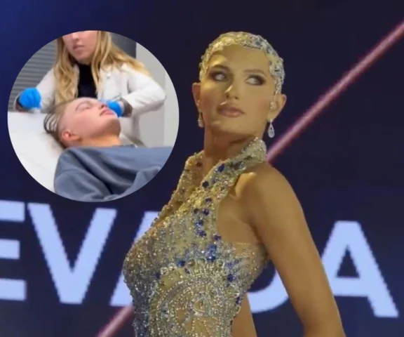 Straciła wszystkie włosy! Teraz może zostać Miss World