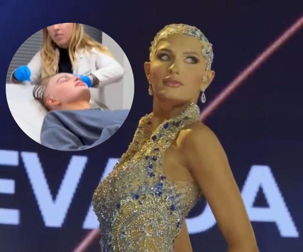 Miss USA Mary Sickler w ozdobnym czepku. Obok miniatura z kobietą u lekarza. O jej walce z chorobą przeczytasz w Eska.