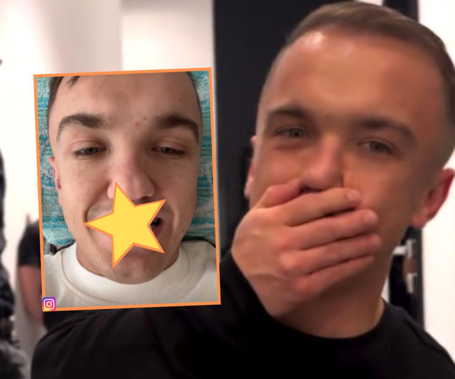 Mini Majk zobaczył, jak za rok będą wyglądały jego nowe zęby