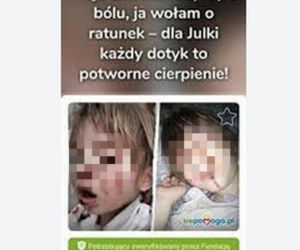 Wyrodna matka zgotowała Julce piekło. Latami wypalała jej kwasem rany na skórze!