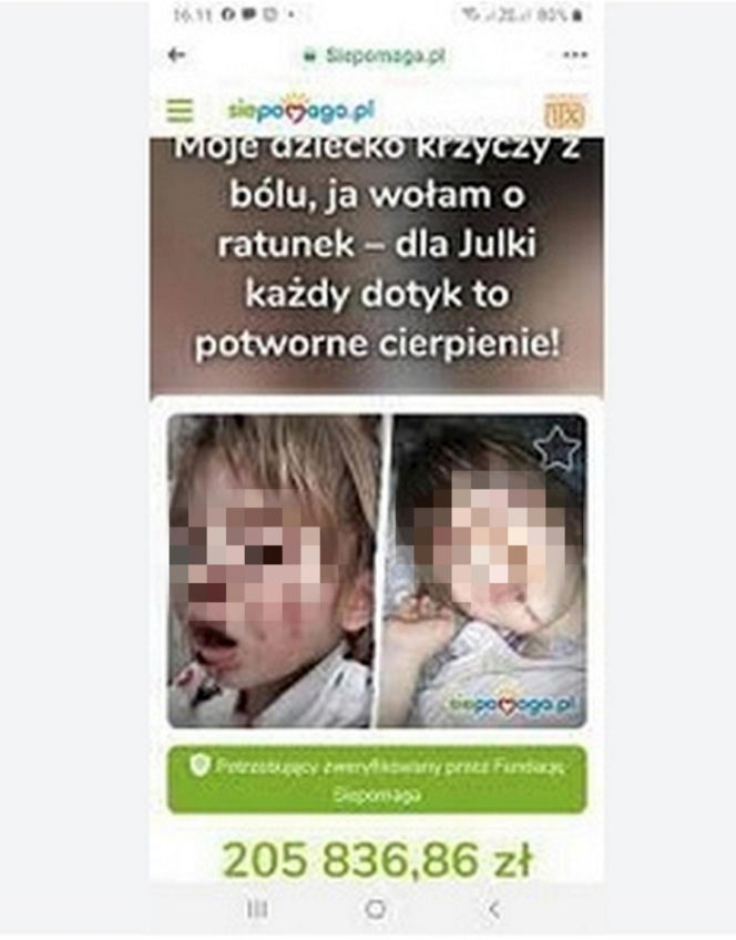 Wyrodna matka zgotowała Julce piekło. Latami wypalała jej kwasem rany na skórze!