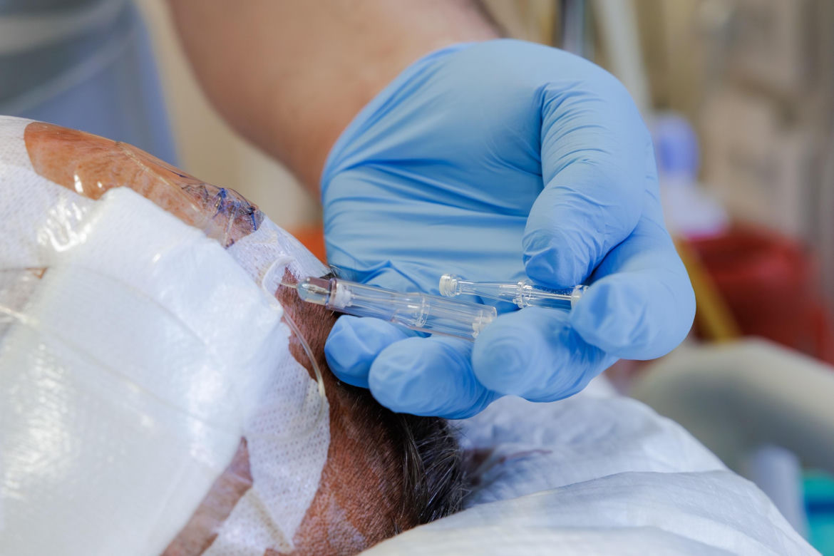 Lubelski szpital ma pierwszy w Polsce aparat do mikrodializy mózgu. To większe szanse dla pacjentów [GALERIA]