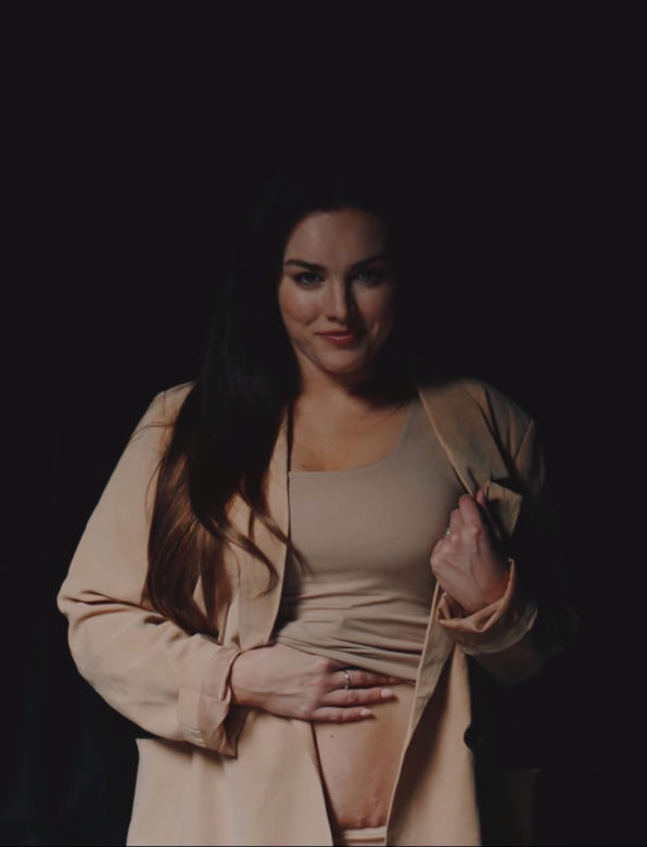 Ewa Farna pokazuje rozstępy