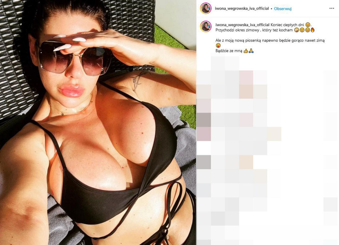 Iwona Węgrowska grozi jej rak skóry