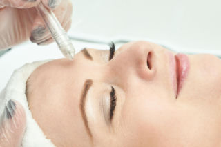 Baby botox wygładza zmarszczki bez efektu maski. Dyskretny trik na naturalną mimikę