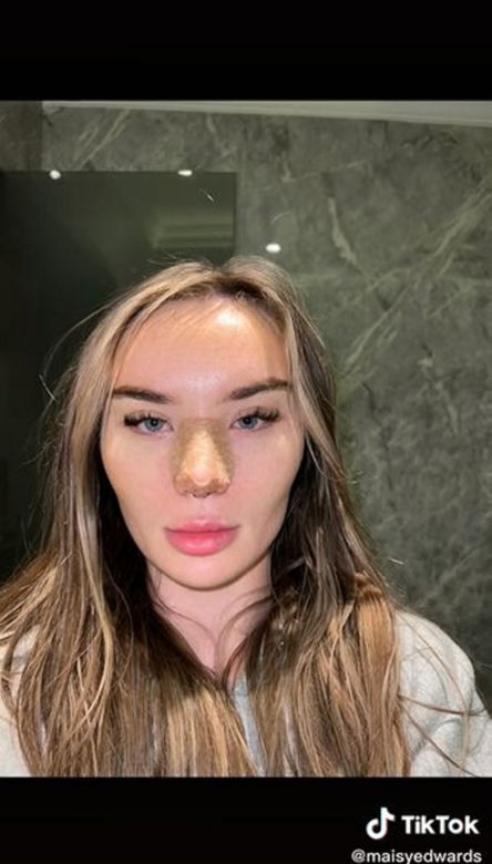 Znana influencerka pojechała do Turcji "zrobić" sobie nos. Wydała 50 tys. zł, fani bezlitośni: "Jest gorzej"
