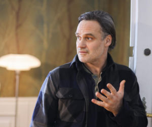 Jan Wieczorkowski przed przeszczepem włosów