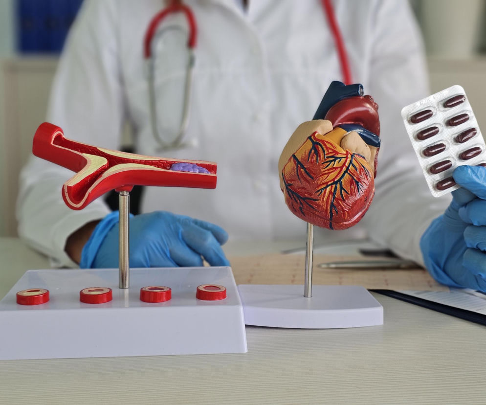 Model serca i przekroju tętnicy z blaszką miażdżycową, obok dłoń w rękawiczce trzymająca blister z kapsułkami, co ilustruje nowe perspektywy leczenia wysokiego cholesterolu opisywane na Poradniku Zdrowie.