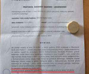 Franek Broda obdukcja