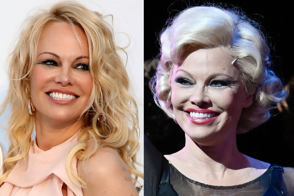  Pamela Anderson ma nową twarz? Szósty rozwód jej posłużył