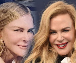  Nicole Kidman ma nową twarz! Nie uwierzysz, gdy ją zobaczysz