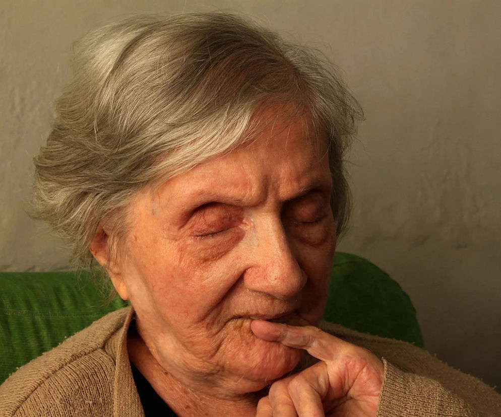 staruszka alzheimer parkinson