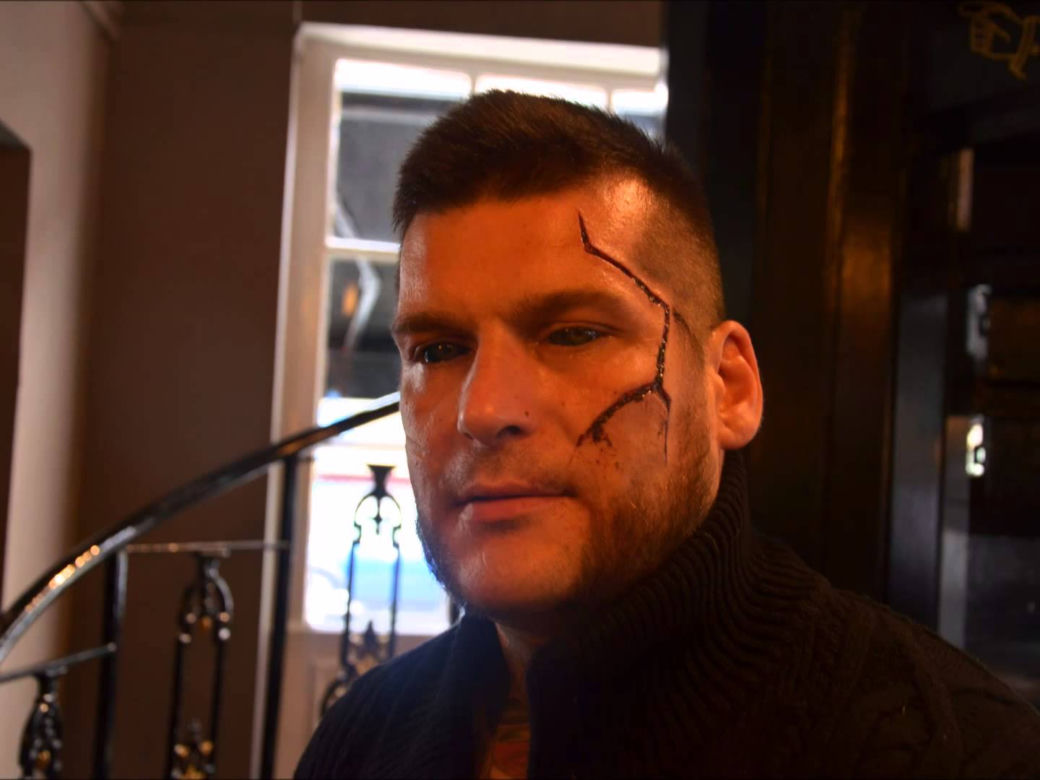 POPEK, GANG ALBANII