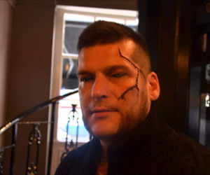 POPEK, GANG ALBANII