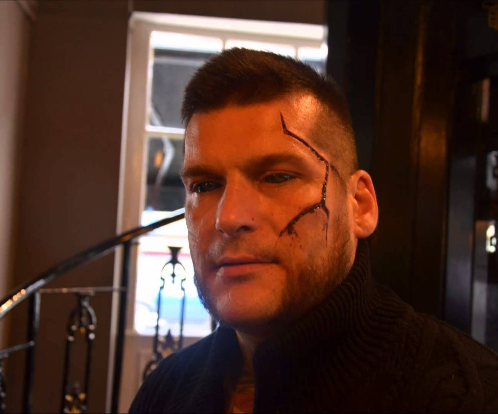 POPEK, GANG ALBANII
