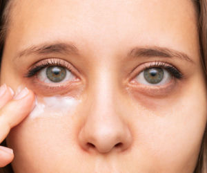 Masz worki pod oczami? Lekarze ostrzegają: to może być pierwszy znak choroby, którą łatwo przeoczyć