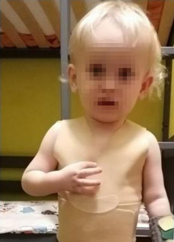Mały Marcelek z Wyszogrodu walczy o powrót do normalności! Jego mama dowiedziała się o chorobie synka w dniu porodu [ZDJĘCIA]