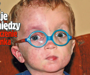 NFZ żałuje pieniędzy na leczenie Marcinka