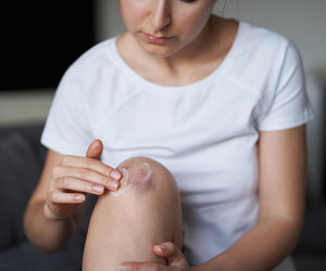 Siniaki „znikąd” mogą nie być przypadkowe. Lekarze coraz częściej mówią o jednej ukrytej przyczynie