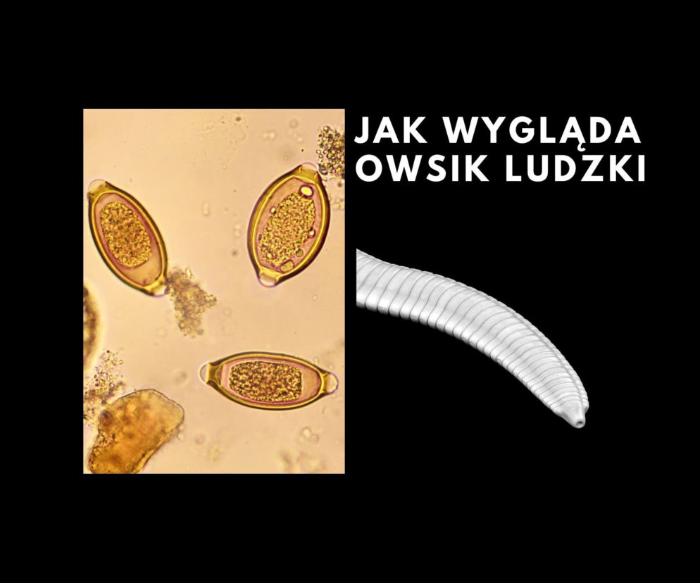 Jak wygląda owsik ludzki?