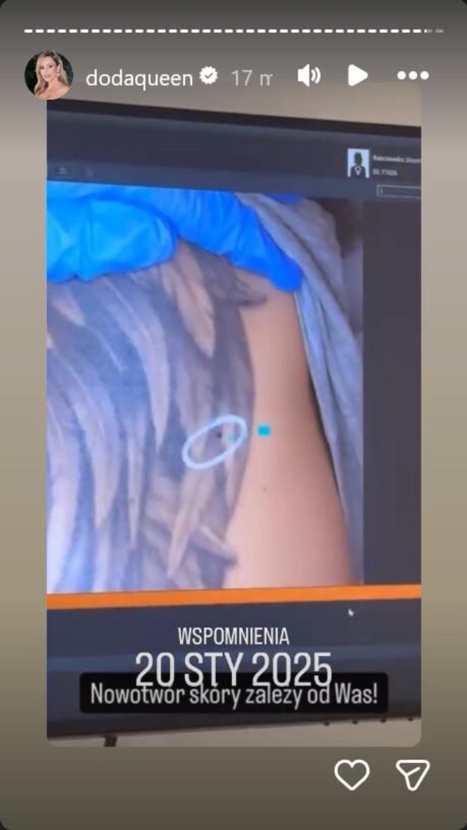 Doda świętuje rocznicę, która uratowała jej życie. Ten post poruszył tysiące