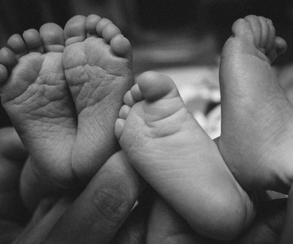 Bliźnięta syjamskie urodzone w Gdańsku zmarły dzień po urodzeniu. Zdjęcie poglądowe