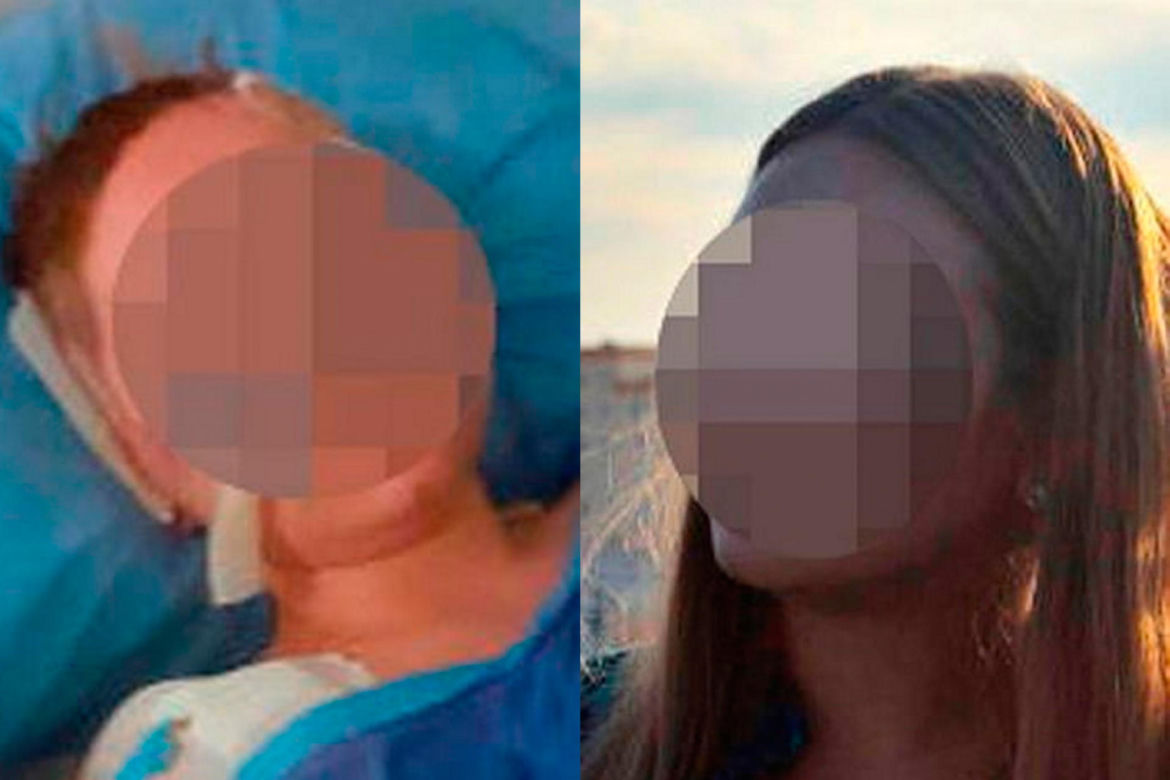Koszmarny wypadek na wakacjach w Egipcie! Paulina straciła rękę [ZDJĘCIA]