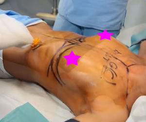 Jak wygląda operacja zmiany płci? Krok po kroku. Zobacz WIDEO [+18]