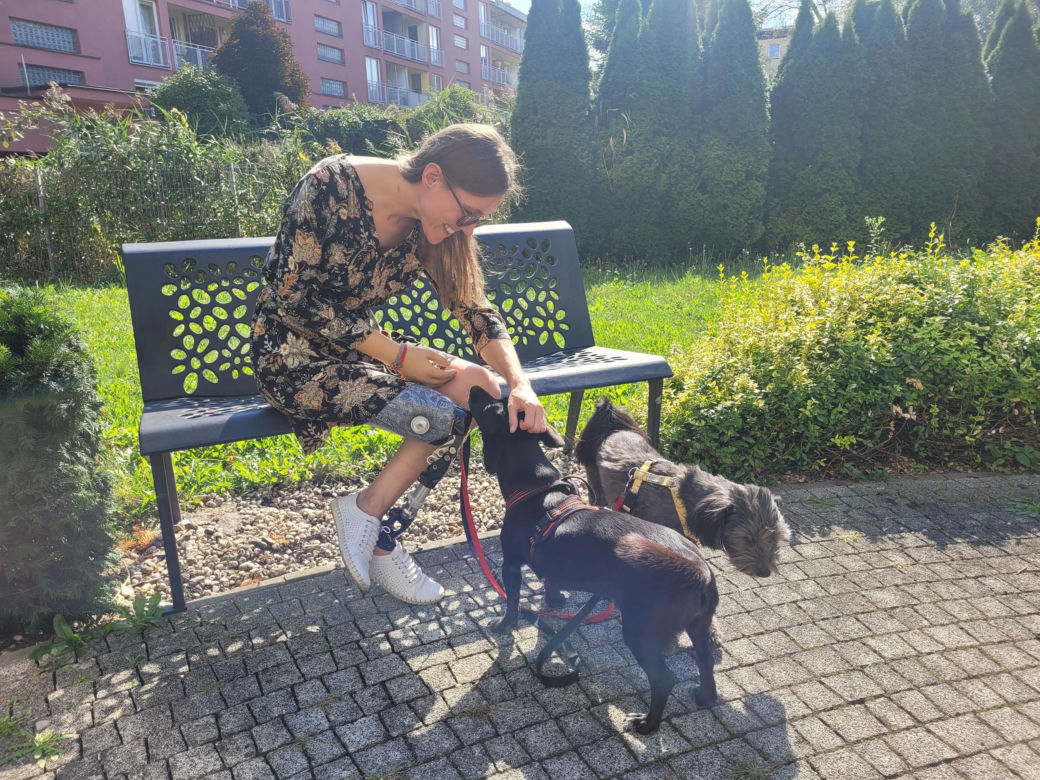 Marlena zbiera na nową protezę