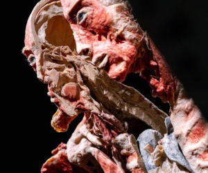 Body Worlds