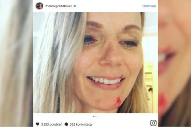 Geri Halliwell oszpecona. Była Spice Girl odparła atak.