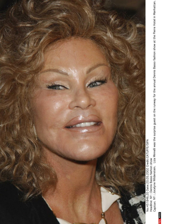 Jocelyn Wildenstein 