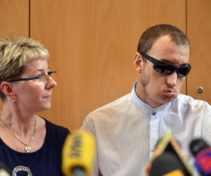 przeszczep twarzy pacjent wyszedl do domu (3)